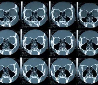 Sinus Scan