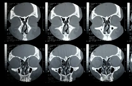 How do you massage for sinus drainage?